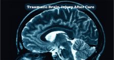 Traumatic Brain Injury After Care. Picture of a scan of the brain.