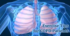 Exercises for People With COPD. Picture of an X-ray showing the lungs and rib cage.
